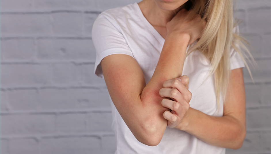 Dermatite seborroica: cause e rimedi