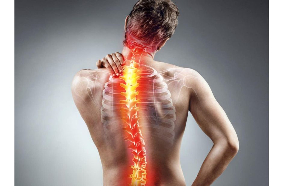  "Affrontare il mal di schiena: Cause, Sintomi e Strategie per il Benessere Spinale"