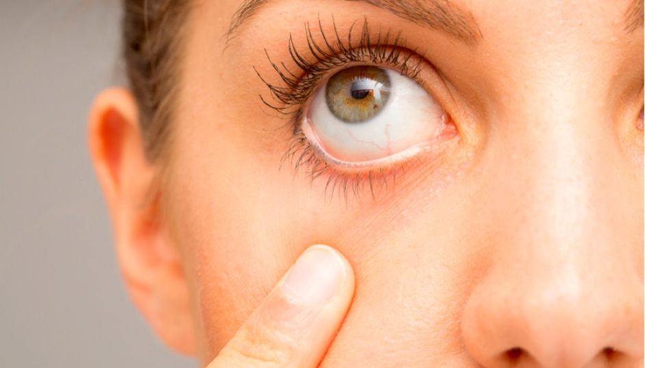 Occhio secco: sintomi e rimedi