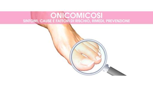 Onicomicosi: Guida Completa alla Prevenzione e al Trattamento